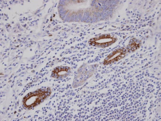 Polyclonal Rabbit anti-Human AKAP10 Antibody (aa600-662, IHC)