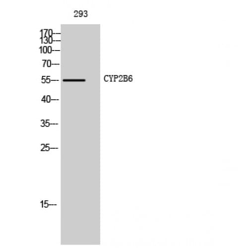 Polyclonal Rabbit anti-Human CYP2B6 Antibody (Internal, WB)