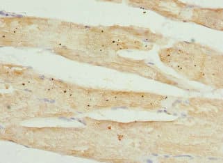 TMOD4 Antibody