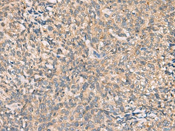 CKLFSF4 / CMTM4 Antibody