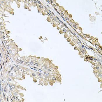CD144 / CDH5 / VE Cadherin Antibody