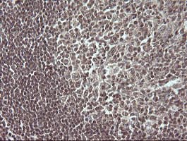 MAP2K3 / MEK3 / MKK3 Antibody (clone OTI6B11, Carrier-free)