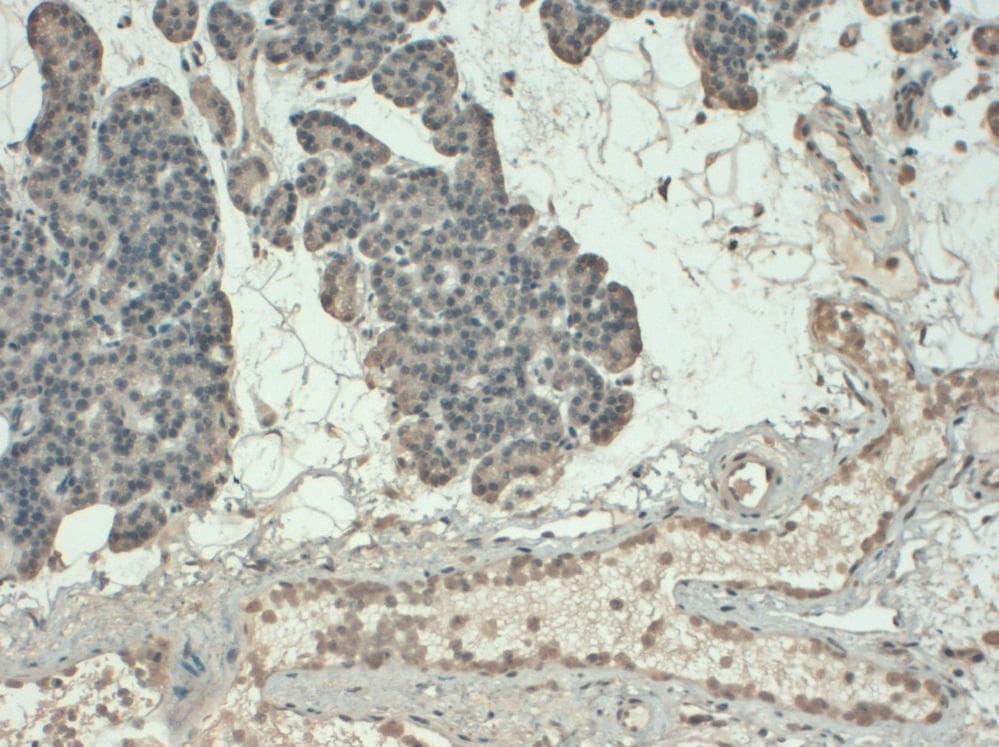 PTH / Parathyroid Hormone Antibody (clone BAM87)
