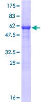 Human GOLPH3 Protein (Recombinant GST)