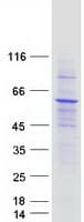 Human IFIT5 Protein (Recombinant Myc-DDK (Flag))