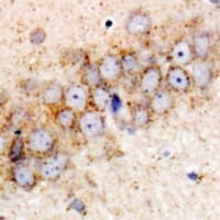 HSPA6 / HSP70B' Antibody