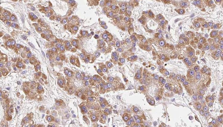 KCNJ10 / SESAME / KIR4.1 Antibody