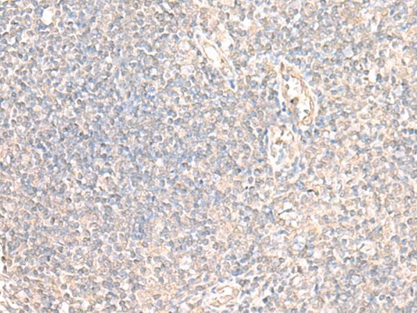 PARS2 Antibody