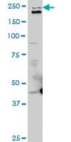 IHC-plus™ TLN1 / Talin 1 Antibody (clone 2E10)