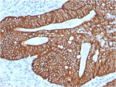 Recombinant Monoclonal Rabbit anti-Human KRT18 / CK18 / Cytokeratin 18 Antibody (clone KRT18/2808R, Azide-free,Carrier-free, IHC, IF, WB)
