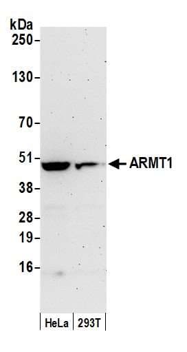 Polyclonal Rabbit anti-Human ARMT1 Antibody (aa391-441, WB)