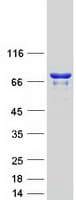 Human ABCF3 Protein (Recombinant Myc-DDK (Flag))