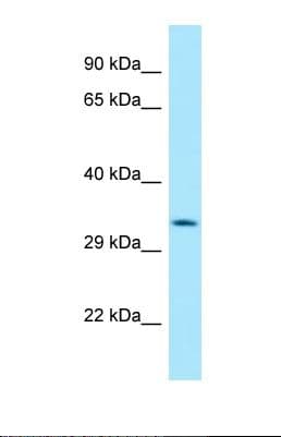 HABP4 Antibody (aa93-142)