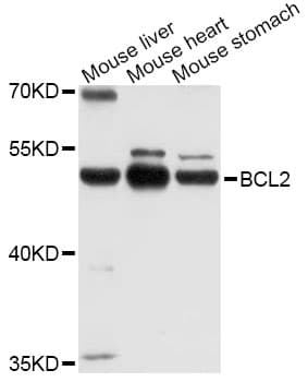 POU2F3 / PLA-1 Antibody