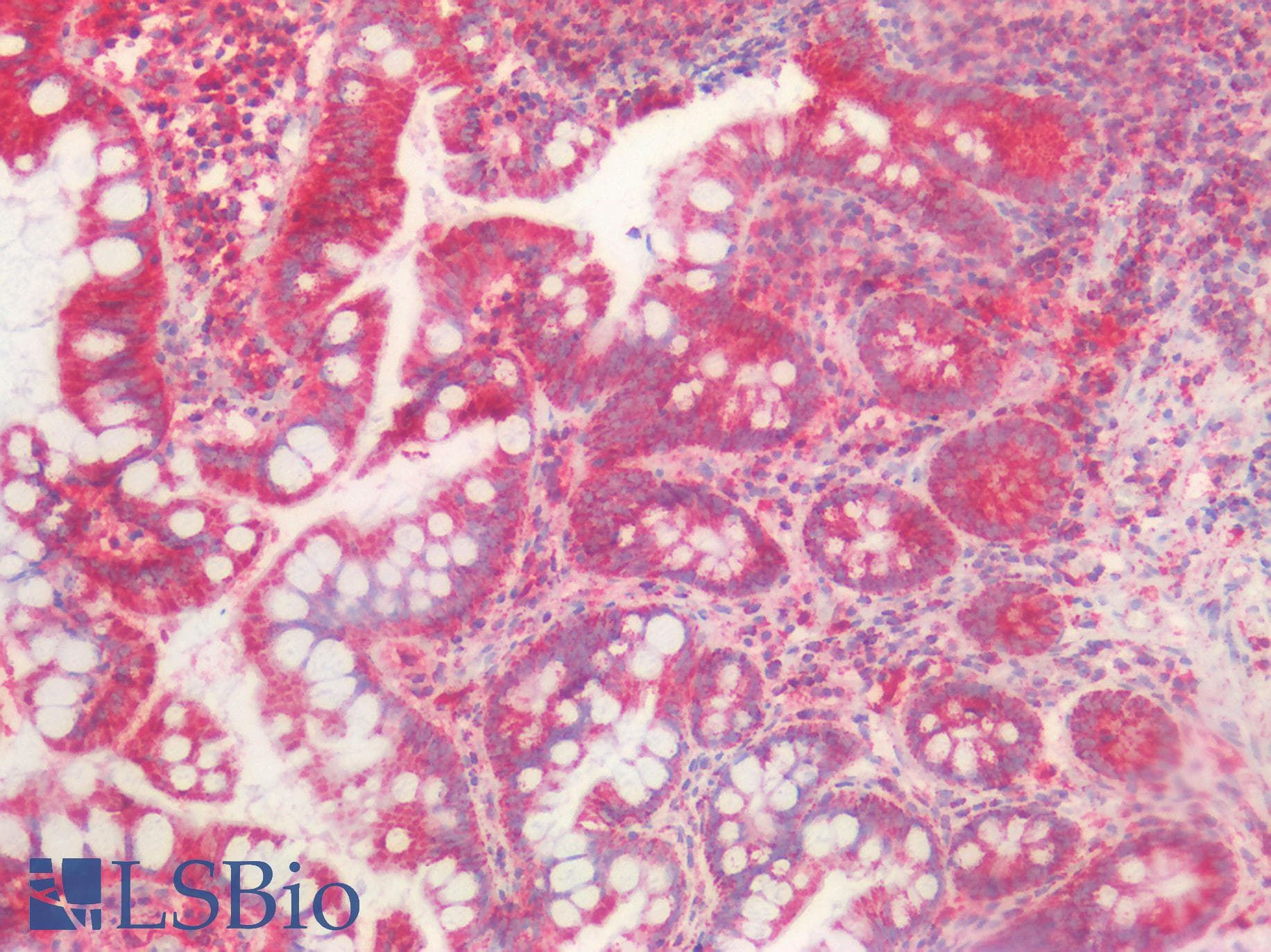 PathPlus™ HSPD1 / HSP60 Antibody (clone OTI3A2)
