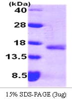 Human IL4 Protein (Recombinant His)