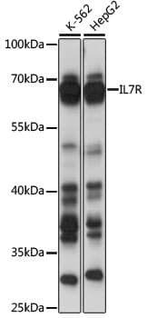 Polyclonal Rabbit anti-Human IL7R / CD127 Antibody (WB)