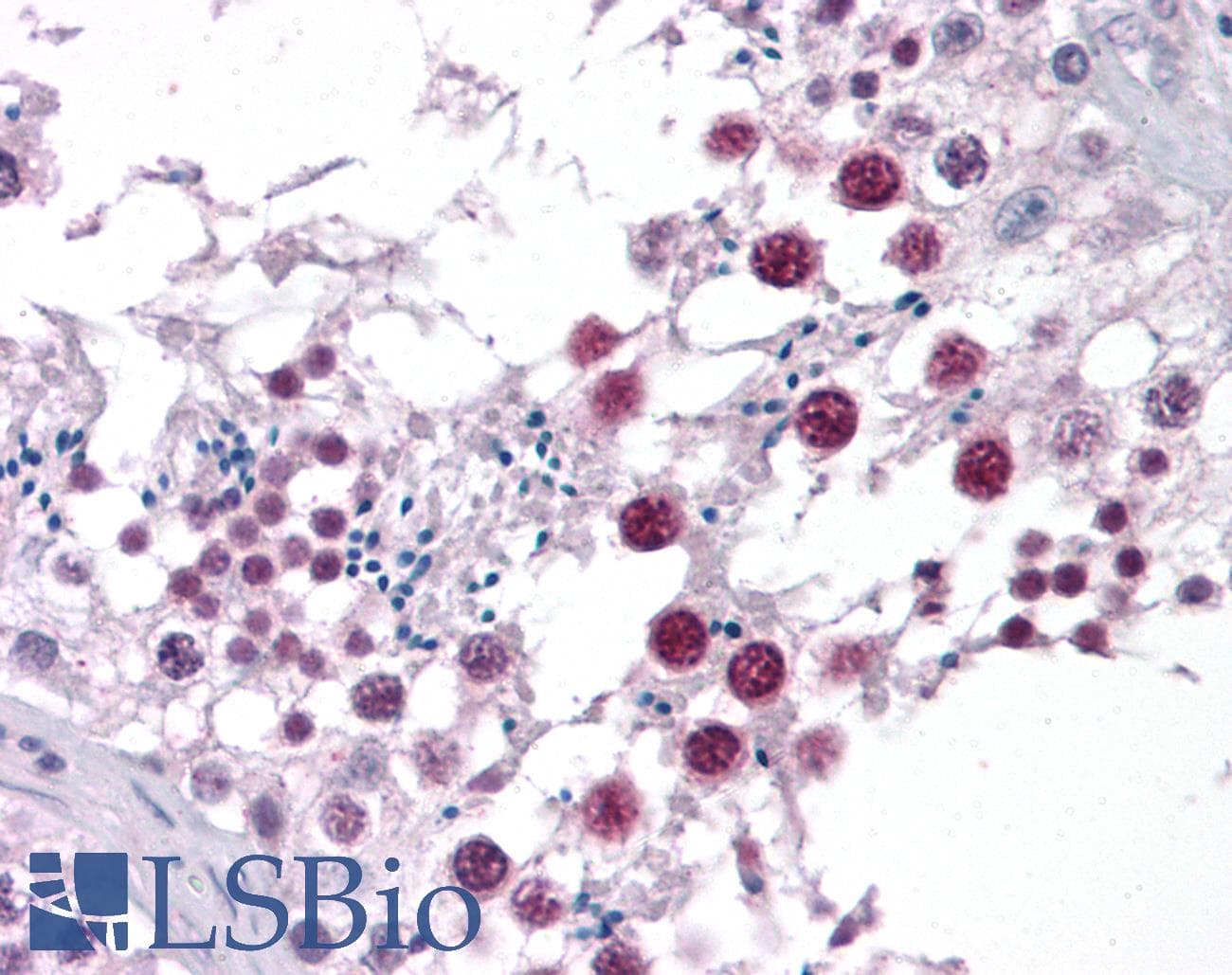 IHC-plus™ Polyclonal Rabbit anti-Human GAS41 Antibody (IHC, WB)