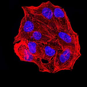 ER Alpha / Estrogen Receptor Antibody (clone 6A6F3)