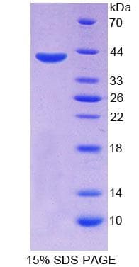 Human ABCA4 Protein (Recombinant His, N-Terminal)