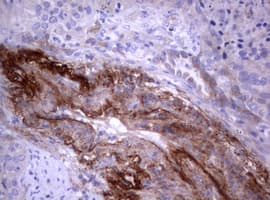 PIK3C2A Antibody (aa230-560, clone OTI4H9)