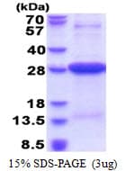 Human HLA-DRA Protein (Recombinant His)