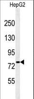 Polyclonal Rabbit anti-Human YME1L1 Antibody (aa191-219, IHC, WB)