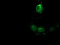 ERIC-1 / TACC3 Antibody (clone OTI3B1)