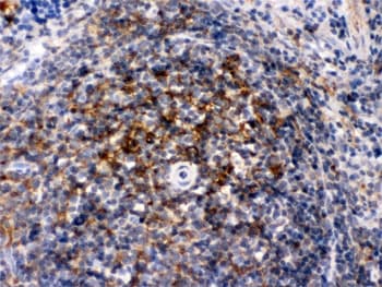 ACTA1 / Skeletal Muscle Actin Antibody