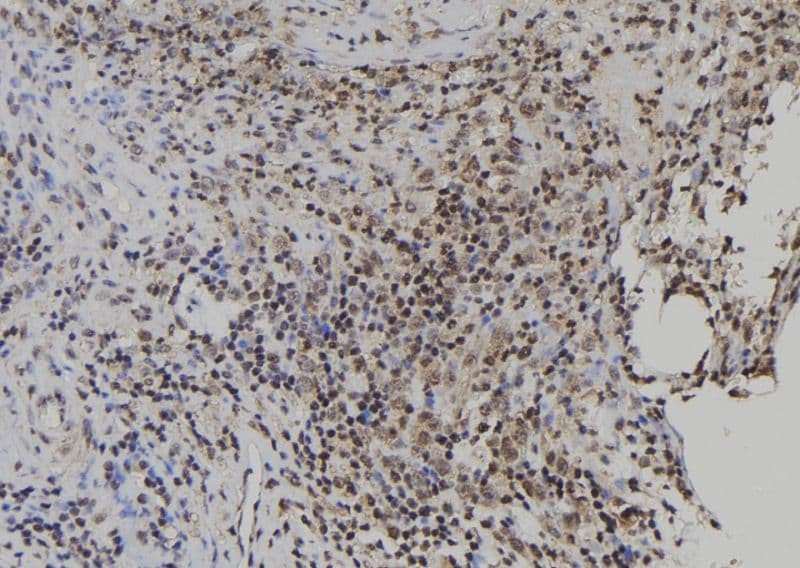 Polyclonal Rabbit anti-Human USP49 Antibody (IHC, WB)