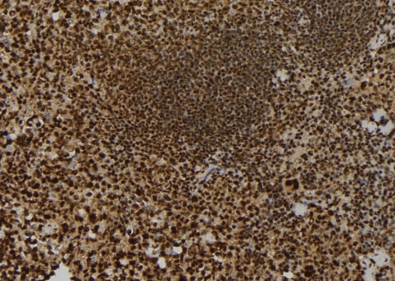 KIF23 / MKLP1 Antibody