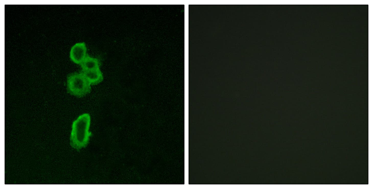 IHC-plus™ FZD6 / Frizzled 6 Antibody (aa116-165)