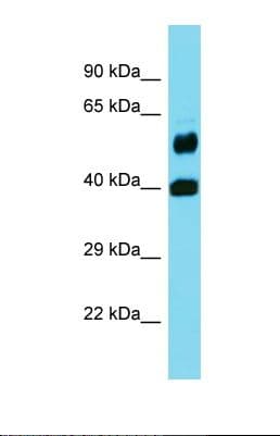 Polyclonal Rabbit anti-Human FOLH1B Antibody (aa172-221, WB)