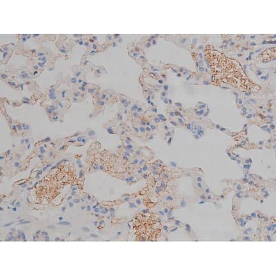 MAPT / Tau Antibody (phospho-Ser356)