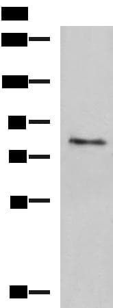 TGM3 / Transglutaminase 3 Antibody
