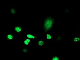 ATRIP Antibody (aa42-309, clone OTI9A4)