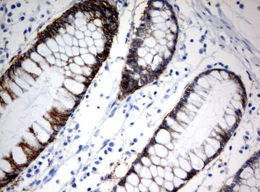 CA12 / Carbonic Anhydrase XII Antibody (clone UMAB121, Carrier-free)