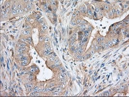 Monoclonal Mouse anti-Human SNX9 / WISP Antibody (clone OTI2B5, IHC, IF, WB)