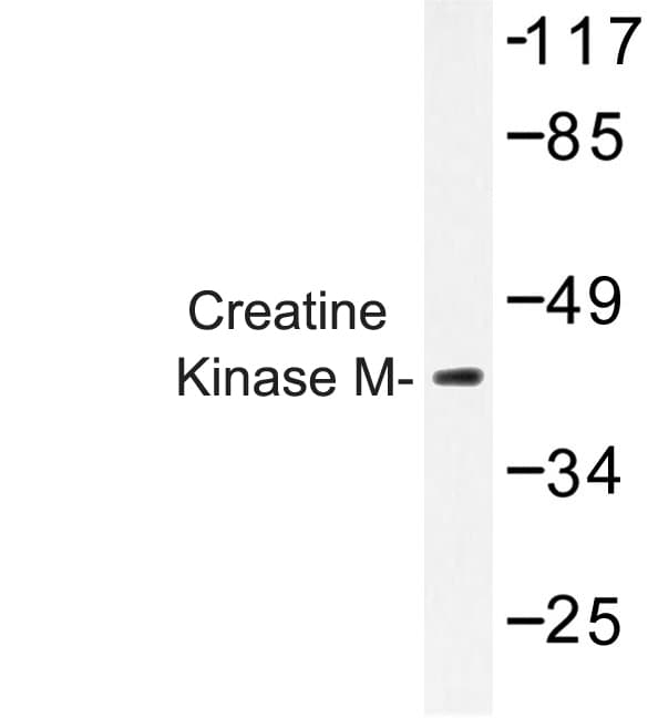 IHC-plus™ CKM / Creatine Kinase MM Antibody (Tyr14)