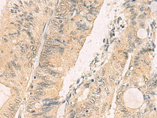 THG1L Antibody