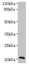 Polyclonal Rabbit anti-Human NICN1 Antibody (IHC, WB)