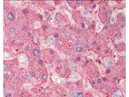 FGA / Fibrinogen Alpha Antibody (Lyophilized, Biotin)