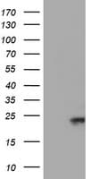 UBE2E3 Antibody (clone OTI4B4)
