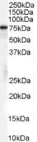 IHC-plus™ HSPA8 / HSC70 Antibody (Isoform 1)