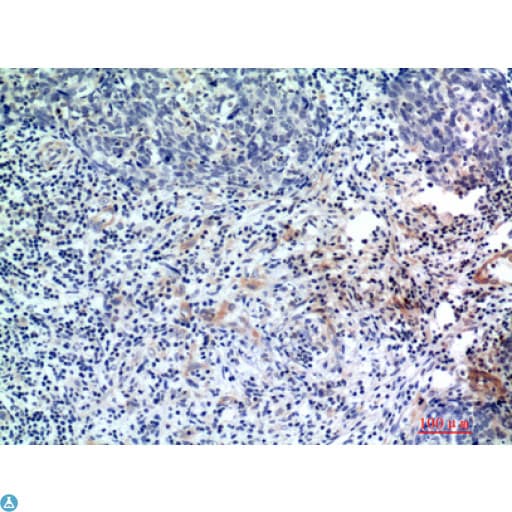 EDA / Ectodysplasin A Antibody