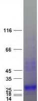Human CGB5 Protein (Recombinant Myc-DDK (Flag))