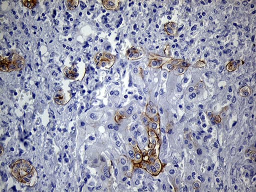 Monoclonal Mouse anti-Human LAD1 Antibody (clone OTI7H8, Carrier-free, aa271-517, IHC, WB)
