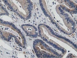 Monoclonal Mouse anti-Human ATG3 Antibody (clone OTI2C12, IHC, IF, WB)