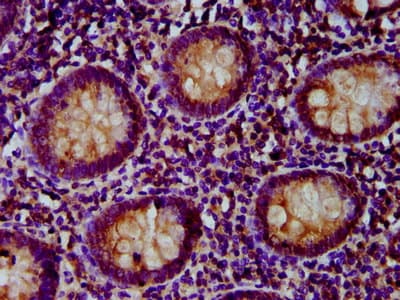 Polyclonal Rabbit anti-Human PNPLA5 Antibody (IHC, IF, WB)