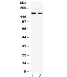 Polyclonal Rabbit anti-Human SAFB1 / SAFB Antibody (WB)